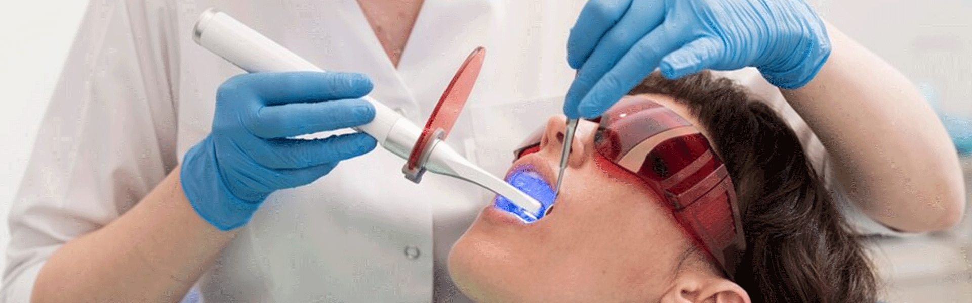 clareamento-dental